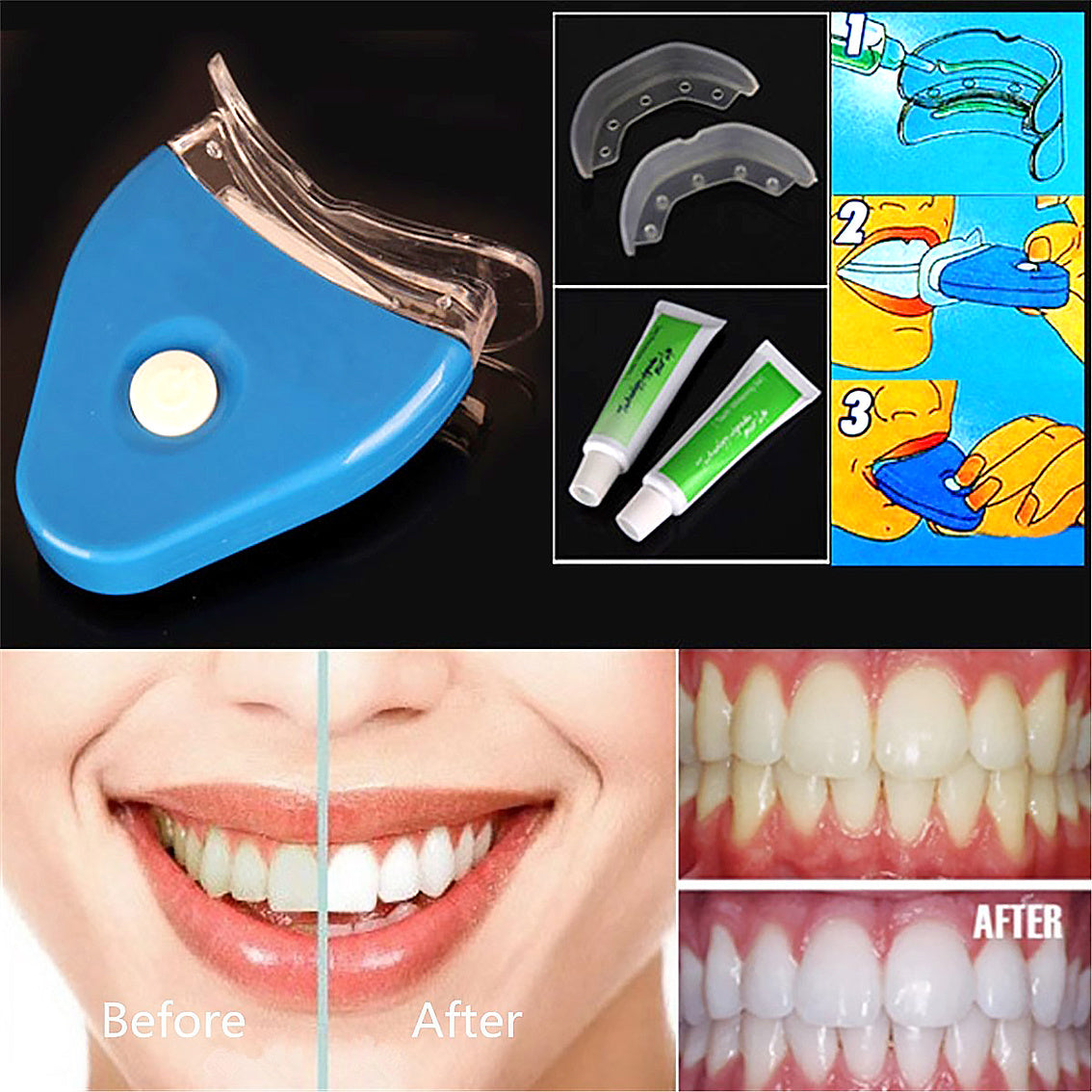 Oral Gel Teeth Tooth Whitening Whitener Dental Bleaching LED - Apple Promo New